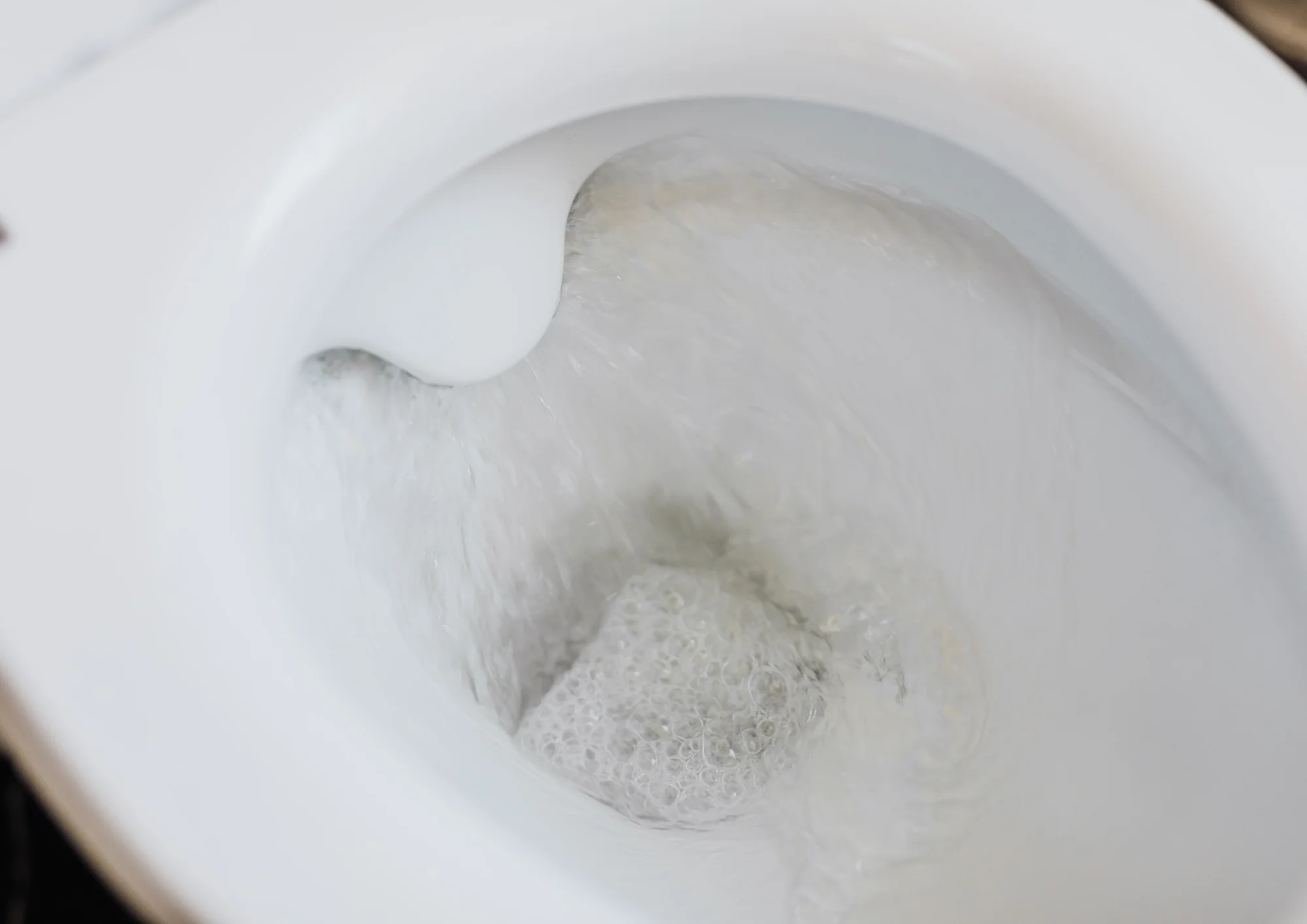 Close-up of a toilet running nonstop after flushing, expert plumbing repair by Springdale Plumbing